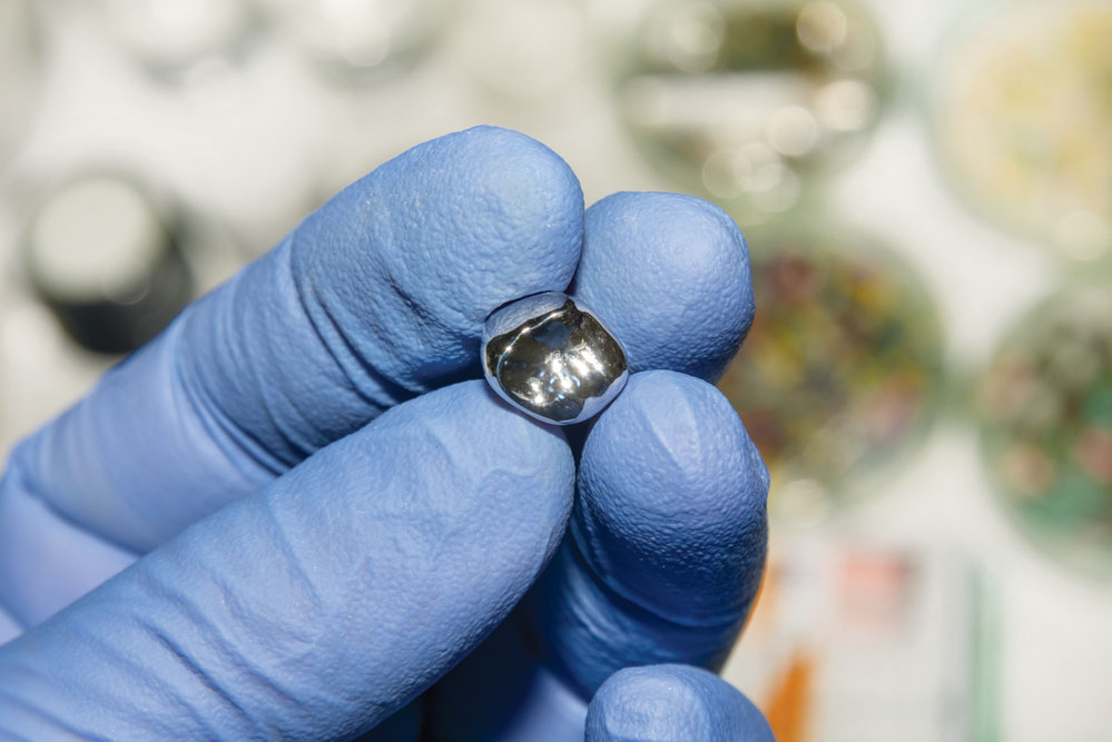 dental amalgam recycling